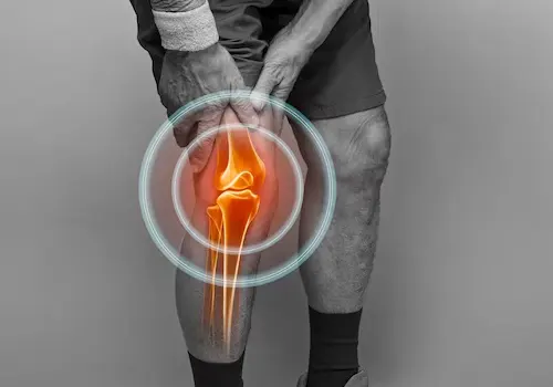 Dor Articular