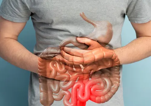 Intestino Preso